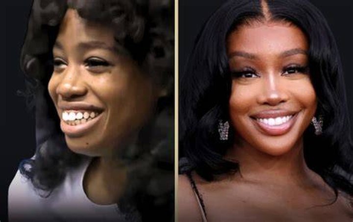 Discoveries Unmasked: SZA's Surgery Journey Unveiled
